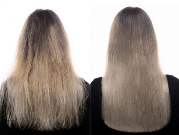 Cauterização capilar antes e depois