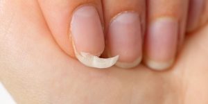 produtos para unhas fracas quais usar