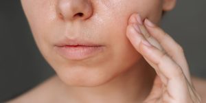 Dermatologistas Revelam os 5 Maiores Erros no cuidado com a Pele Oleosa